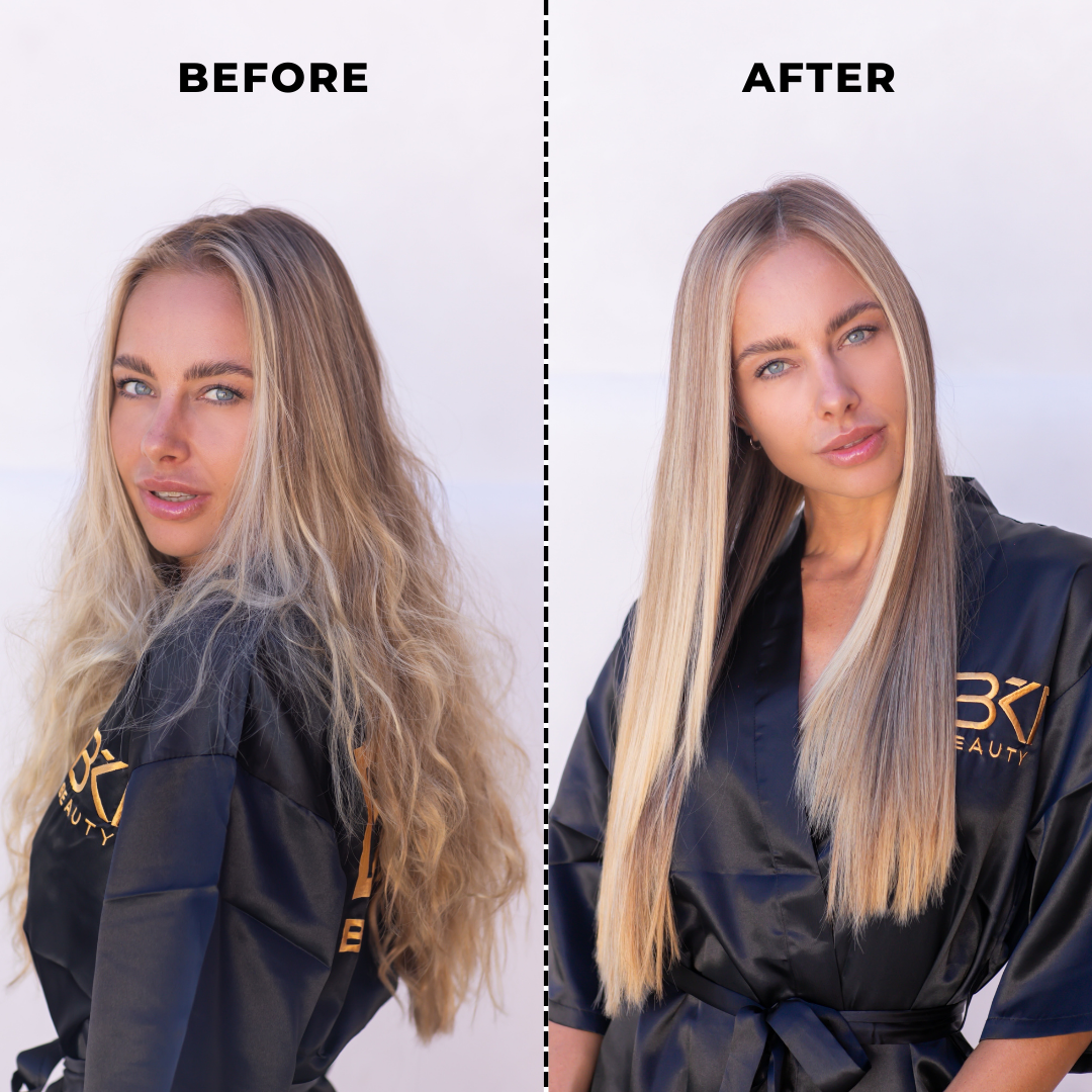 Nanoplasty before and after result at Smart Hair Auckland