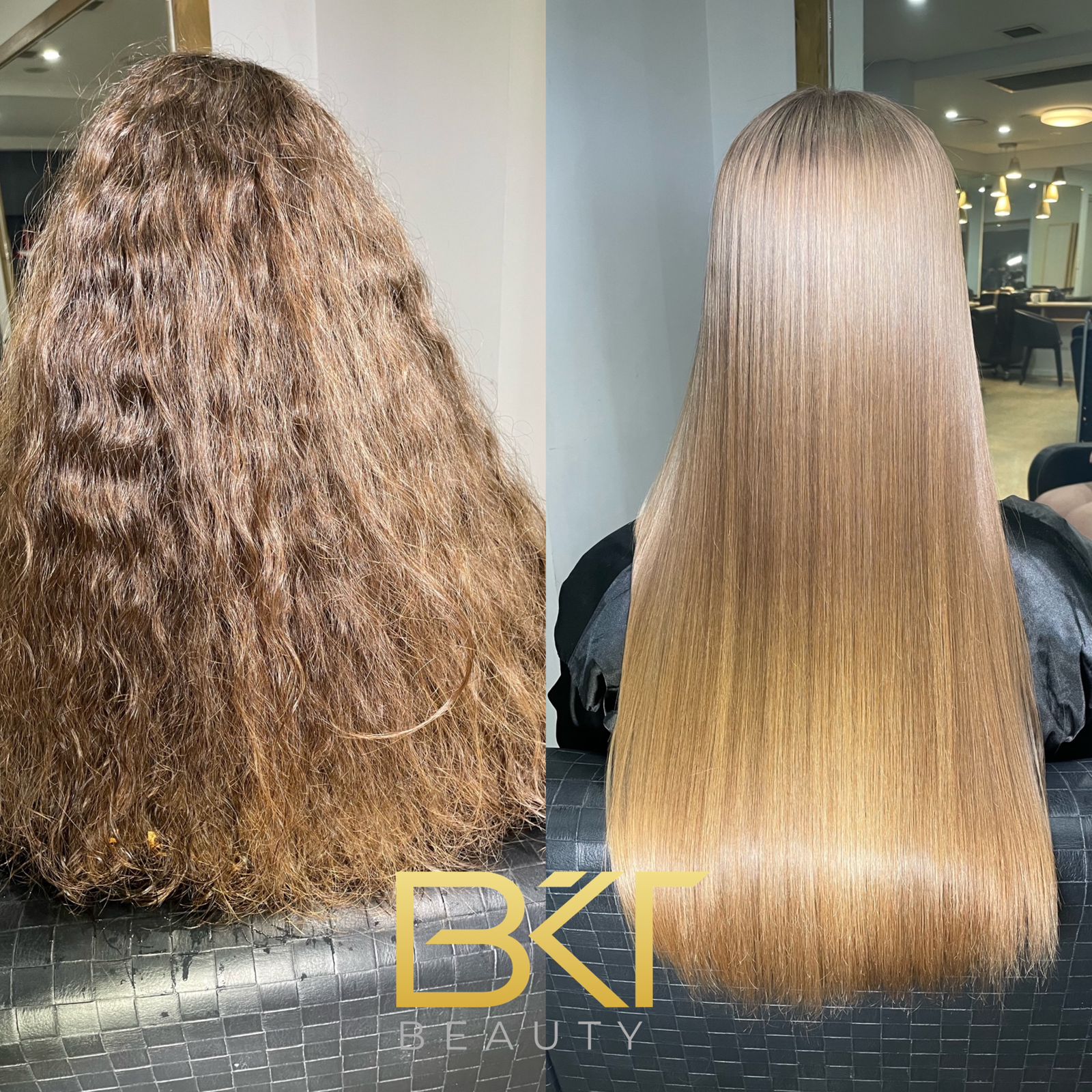 Light brown hair nanoplasty result